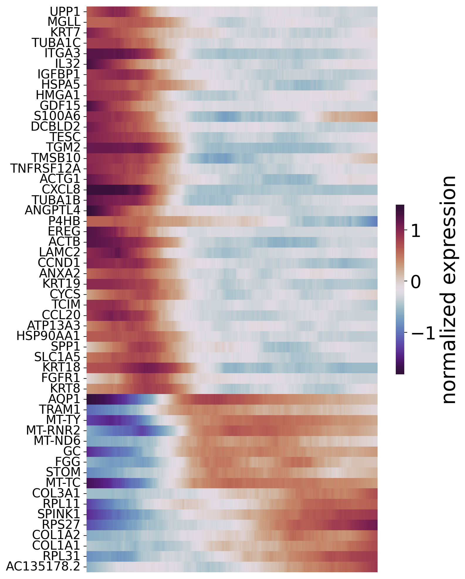 ../_images/notebooks_02.ST_data_of_Intrahepatic_cholangiocarcinoma_cancer_46_0.png
